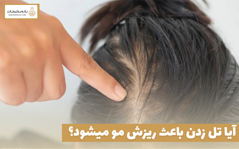 آیا تل زدن باعث ریزش مو میشود؟